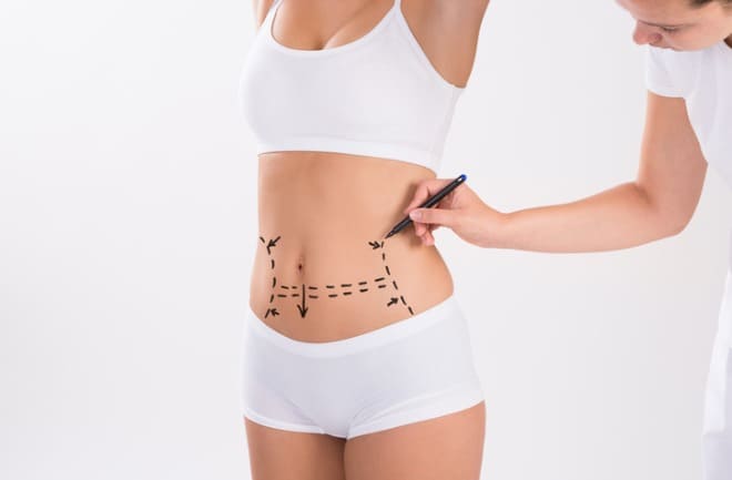 abdominoplastia e transformação do corpo