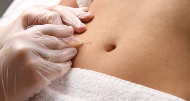 Carboxiterapia Para Estrias