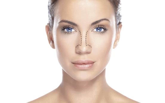 Mulher com desenho no rosto para uma cirurgia plástica de nariz