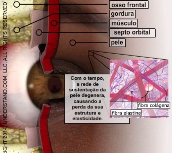 Como funciona a cirurugia de pálpebras