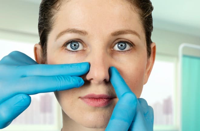 rinoplastia funcional