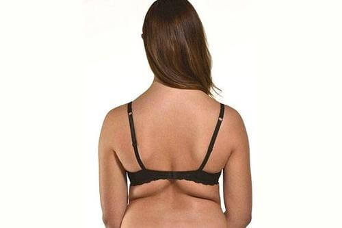 Gordura localizada nas costas