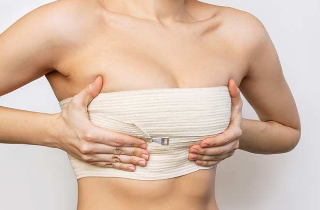 mulher após implante mamário com incisão inframamária