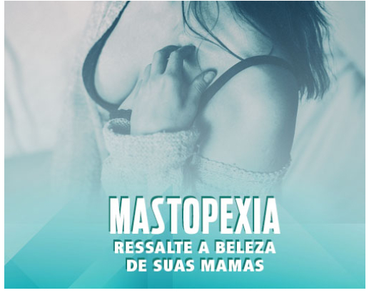 Entenda mais sobre a mastopexia e todas as vantagens do procedimento!