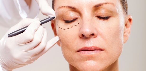 Cirurgia plástica das palpebras