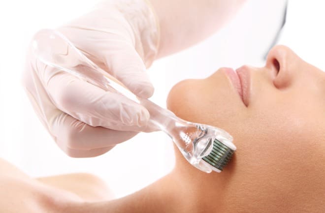 mulher realizando procedimento de microagulhamento