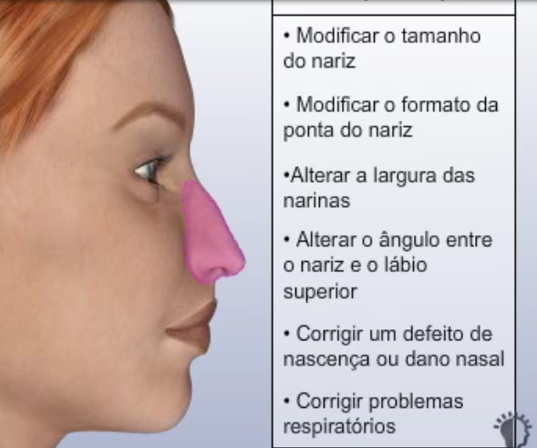 objetivos ao realizar uma rinoplastia