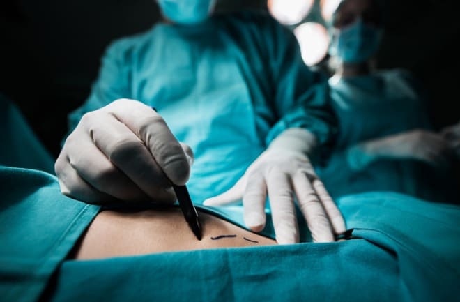 cirurgia plastica sendo feita