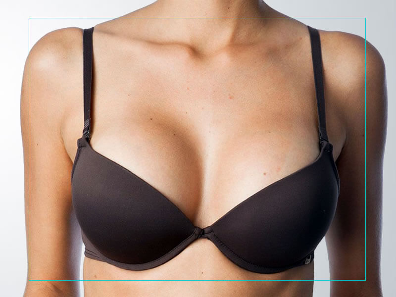  Silicone nos seios com momento específio 