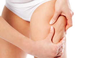 mulher com as mãos na perna com celulites